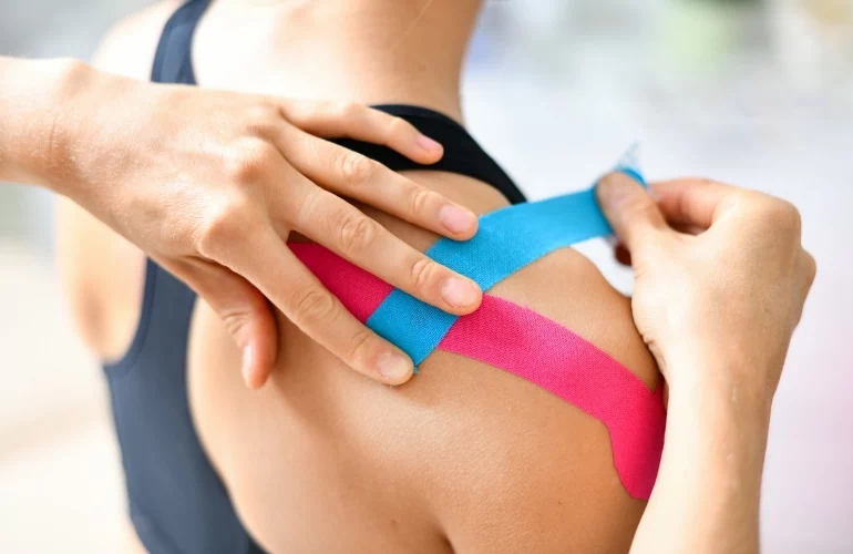 Kinezytaping